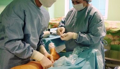 Operazione per vene varicose