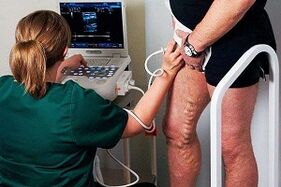 Opzioni diagnostiche per vene varicose sulle gambe