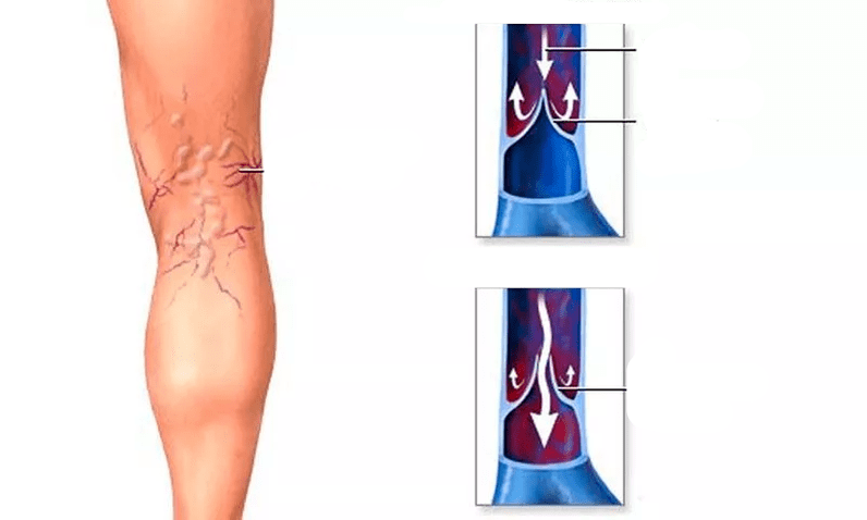 movimento del sangue