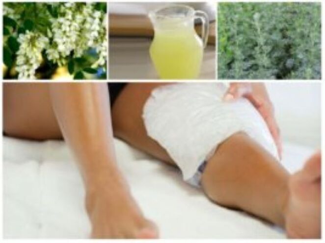 Un metodo popolare molto efficace per il trattamento delle vene varicose è l'uso di impacchi.