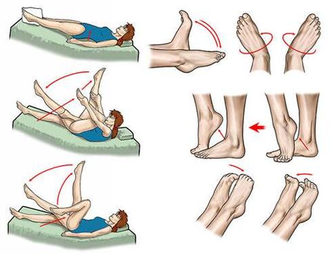 metodi di trattamento delle vene varicose del bacino