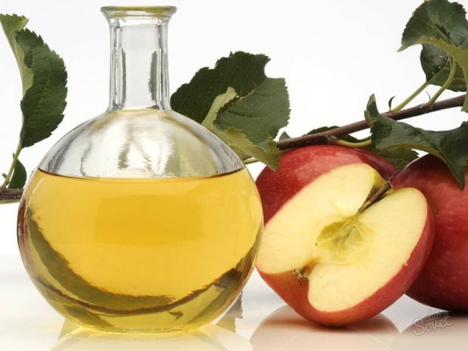 aceto di mele per vene varicose